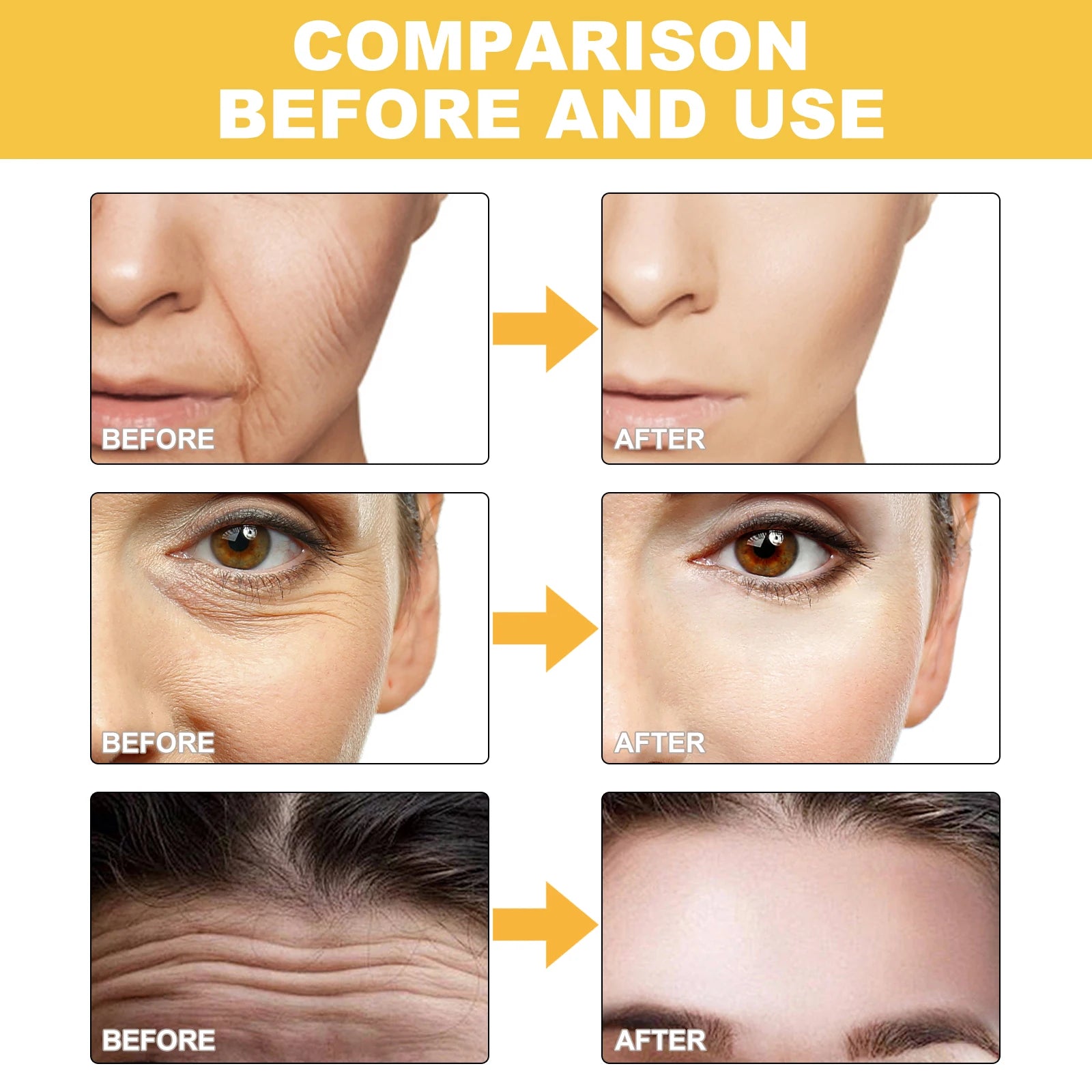 Collagen Wrinkle Patches Treatment