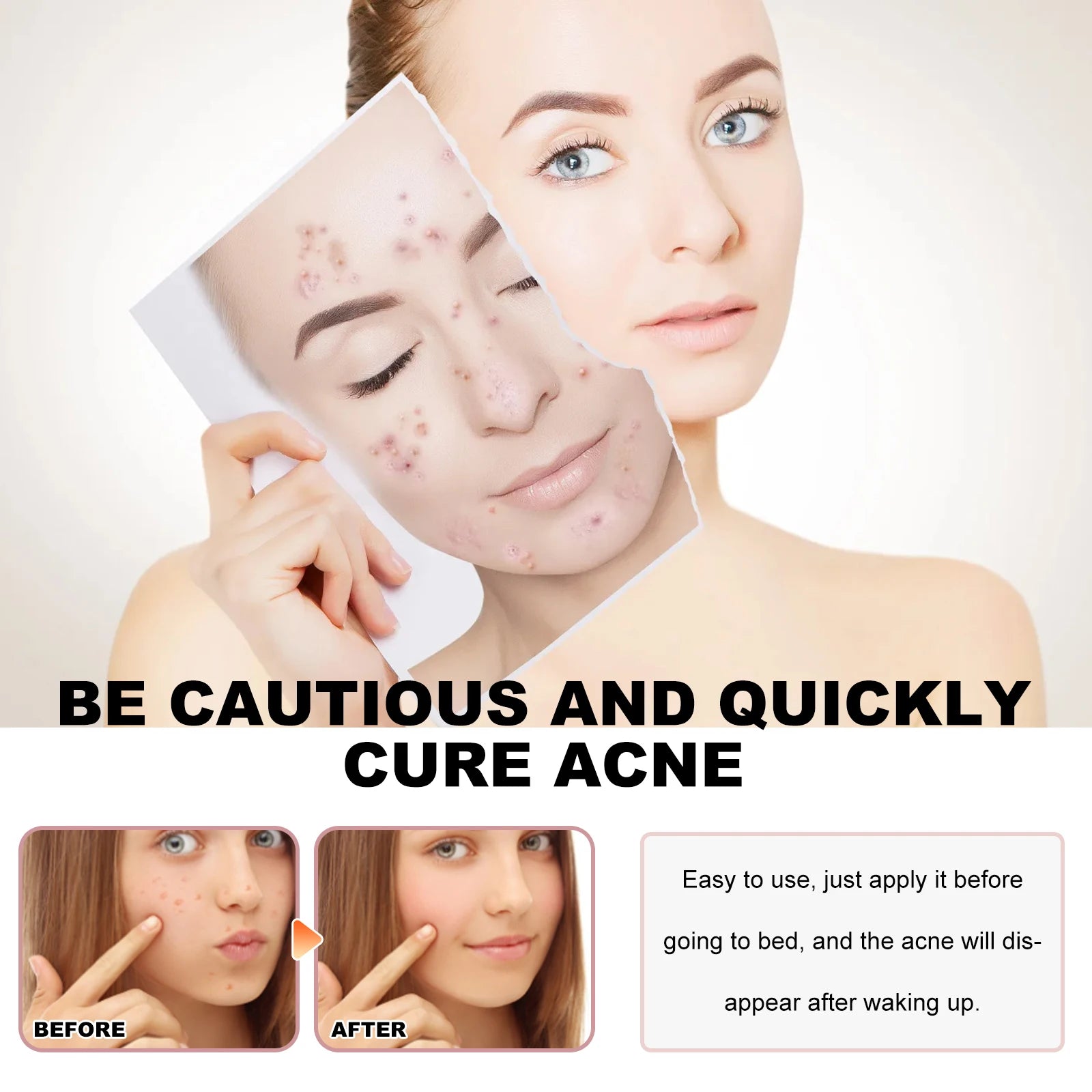 Hoygi Cute Color Acne Care Patches