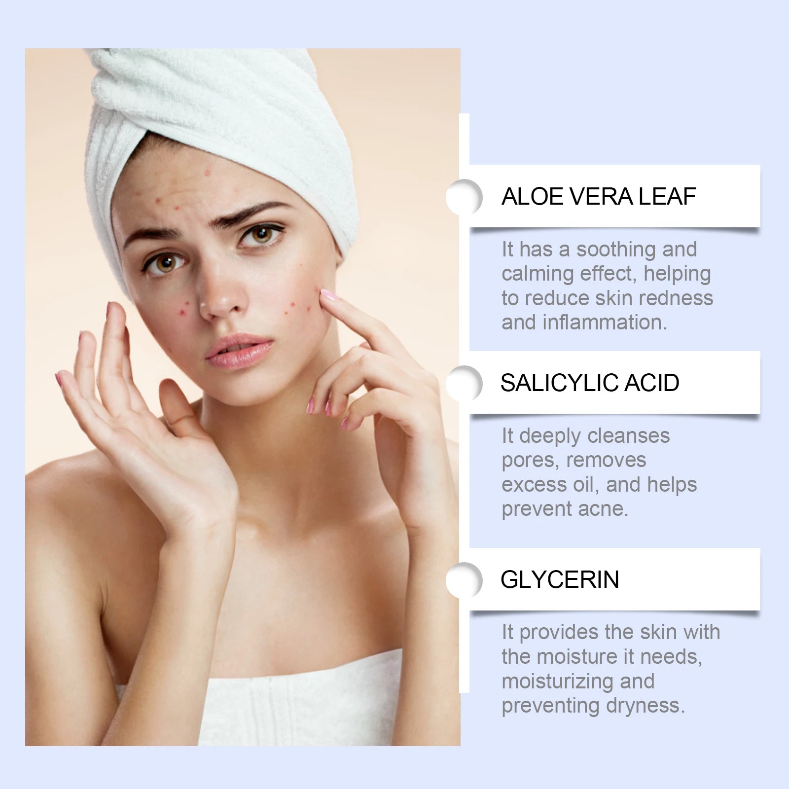 South Moon Herbal Acne Cream 20g