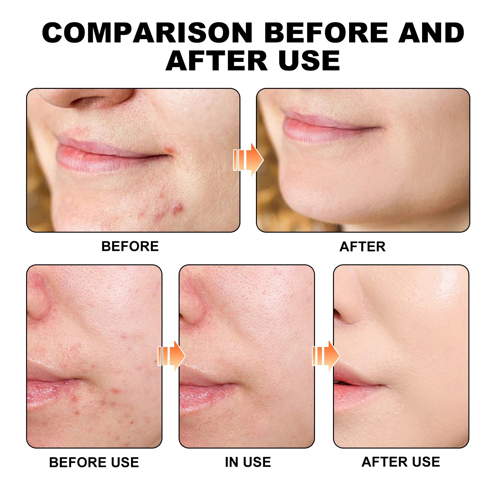 Hoygi Cute Color Acne Care Patches