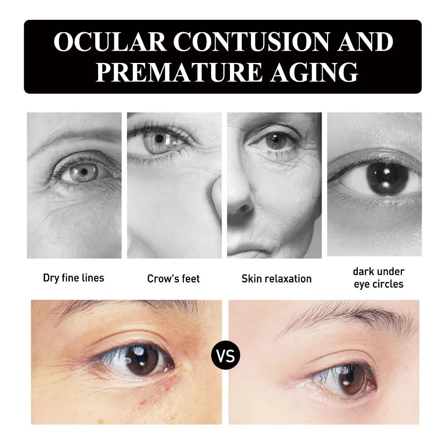 Hoygi Strawberry Gel Eye Patches