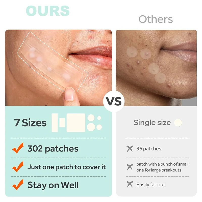 302Pcs Invisible Waterproof Acne Patches
