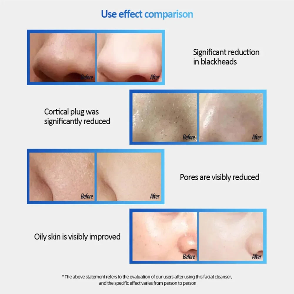 Sonic Rechargeable Facial Cleansing Brush