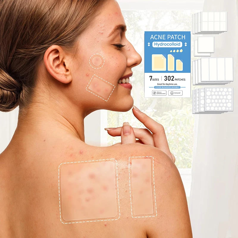 302Pcs Invisible Waterproof Acne Patches