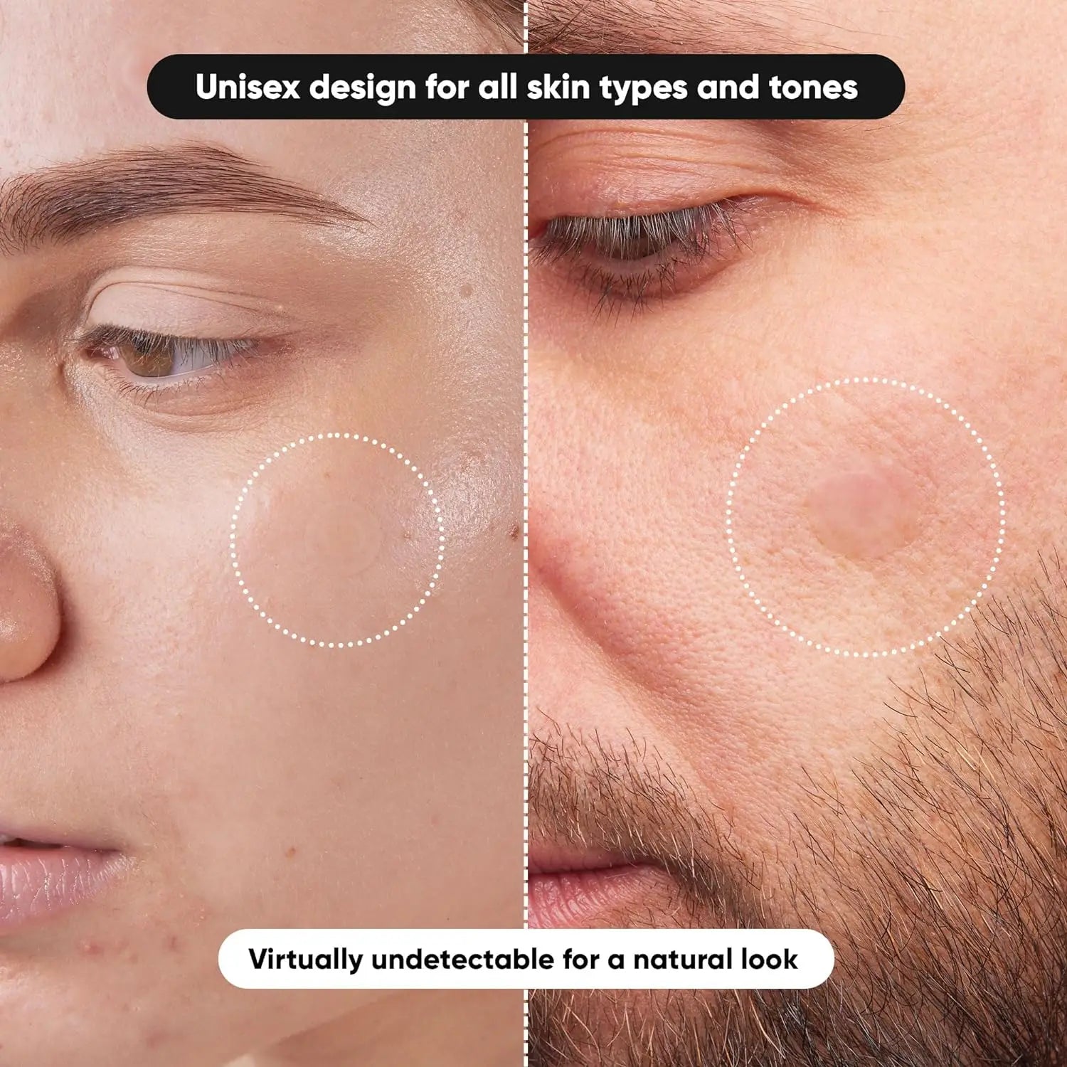 800 Stück unsichtbare Akne-Pickel-Pflaster