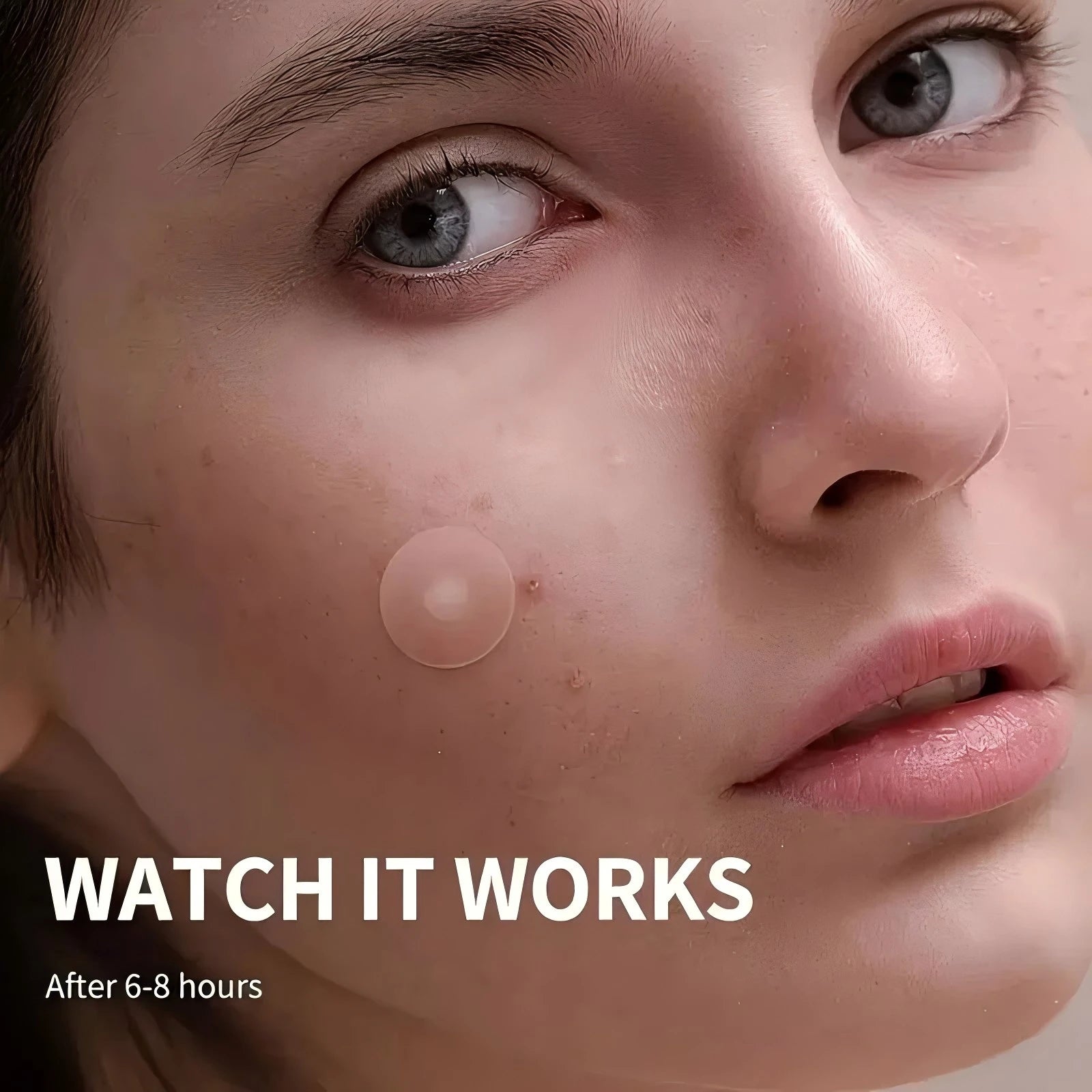 48 Stück unsichtbare Akne-Pickel-Patch-Aufkleber