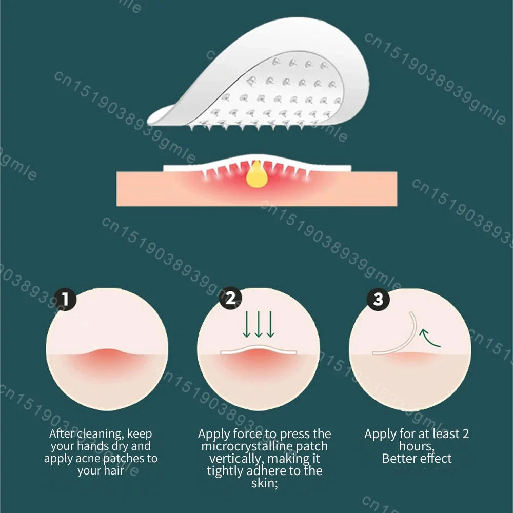 Invisible Microneedle Acne Repair Patch